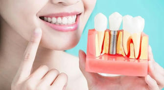 How to Determine If You Are Suitable for Dental Implants